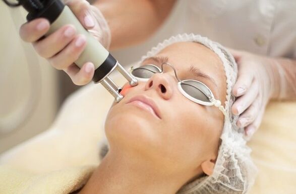 Heat exposure to epidermis